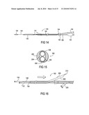 Catheter system for angioplasty and stenting with embolic protection diagram and image