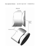 DYNAMIC SPINAL IMPLANTS INCORPORATING CARTILAGE BEARING GRAFT MATERIAL diagram and image