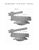 DYNAMIC SPINAL IMPLANTS INCORPORATING CARTILAGE BEARING GRAFT MATERIAL diagram and image