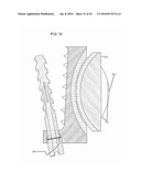 DYNAMIC SPINAL IMPLANTS INCORPORATING CARTILAGE BEARING GRAFT MATERIAL diagram and image