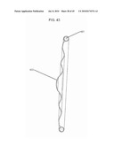 DYNAMIC SPINAL IMPLANTS INCORPORATING CARTILAGE BEARING GRAFT MATERIAL diagram and image