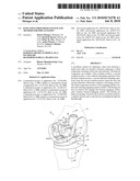 Knee Joint Prosthesis System and Method for Implantation diagram and image