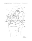 Knee Joint Prosthesis System and Method for Implantation diagram and image