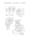 Knee Joint Prosthesis System and Method for Implantation diagram and image