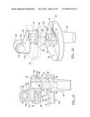 Knee Joint Prosthesis System and Method for Implantation diagram and image