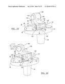 Knee Joint Prosthesis System and Method for Implantation diagram and image