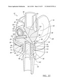 Knee Joint Prosthesis System and Method for Implantation diagram and image