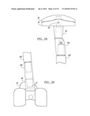 Knee Joint Prosthesis System and Method for Implantation diagram and image