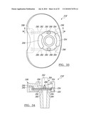 Knee Joint Prosthesis System and Method for Implantation diagram and image