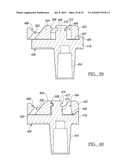 Knee Joint Prosthesis System and Method for Implantation diagram and image