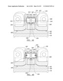 Knee Joint Prosthesis System and Method for Implantation diagram and image