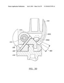 Knee Joint Prosthesis System and Method for Implantation diagram and image