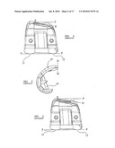 KNEE PROSTHESES diagram and image