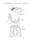 KNEE PROSTHESES diagram and image