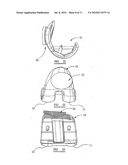 KNEE PROSTHESES diagram and image