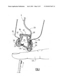 OBSTACLE DETECTION DEVICE, IN PARTICULAR A FRAME FOR A MOTORISED OPENING PANEL OF A MOTOR VEHICLE, AND RESULTING OPENING PANEL diagram and image