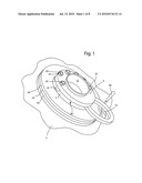 VESSEL PORT CONFIGURED FOR USE WITH A GLOVE BAG diagram and image