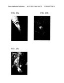 System And Method For Projection of Subsurface Structure Onto An Object s Surface diagram and image