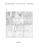 TRANSGENIC ONCOLYTIC VIRUSES AND USES THEREOF diagram and image