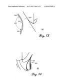 Golf Club Heads With Augmented Side Surfaces And Weighting, And Related Methods diagram and image