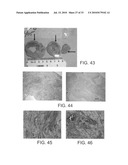 INJECTABLE CROSS-LINKED POLYMERIC PREPARATIONS AND USES THEREOF diagram and image