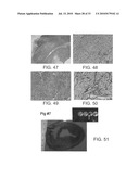 INJECTABLE CROSS-LINKED POLYMERIC PREPARATIONS AND USES THEREOF diagram and image