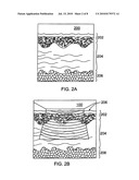 Method of enhancing skin appearance through the combination of Titan TM and TMR methods diagram and image