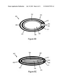 DEVICES, SYSTEMS, AND METHODS FOR DEFORMING A BODY CHANNEL diagram and image