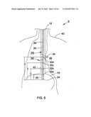 MEDICAL TUBE SYSTEM WITH POSITION SENSING diagram and image