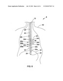 MEDICAL TUBE SYSTEM WITH POSITION SENSING diagram and image