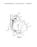 TRANSESOPHAGEAL ULTRASOUND USING A NARROW PROBE diagram and image