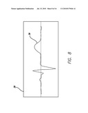 DEVICE AND PROCEDURE FOR VISUAL THREE-DIMENSIONAL PRESENTATION OF ECG DATA diagram and image