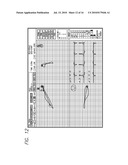 DEVICE AND PROCEDURE FOR VISUAL THREE-DIMENSIONAL PRESENTATION OF ECG DATA diagram and image