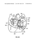 METHOD AND DEVICES FOR PERFORMING BIATRIAL COAGULATION diagram and image