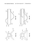 METHOD AND DEVICES FOR PERFORMING BIATRIAL COAGULATION diagram and image