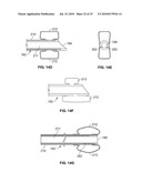 METHOD AND DEVICES FOR PERFORMING BIATRIAL COAGULATION diagram and image