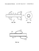 METHOD AND DEVICES FOR PERFORMING BIATRIAL COAGULATION diagram and image