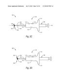 CLOSURE DEVICES, SYSTEMS, AND METHODS diagram and image