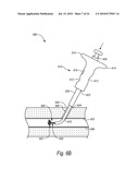 CLOSURE DEVICES, SYSTEMS, AND METHODS diagram and image