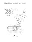 CLOSURE DEVICES, SYSTEMS, AND METHODS diagram and image