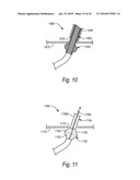 CLOSURE DEVICES, SYSTEMS, AND METHODS diagram and image