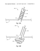 CLOSURE DEVICES, SYSTEMS, AND METHODS diagram and image