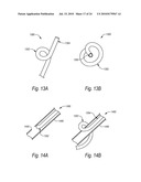 CLOSURE DEVICES, SYSTEMS, AND METHODS diagram and image