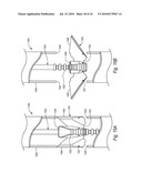 CLOSURE DEVICES, SYSTEMS, AND METHODS diagram and image