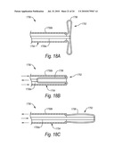 CLOSURE DEVICES, SYSTEMS, AND METHODS diagram and image