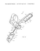 Methods for the Surgical Application of a Fastener and the Endoluminal Treatment of Gastroesophageal Reflux Disease (GERD) diagram and image