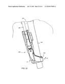 Methods for the Surgical Application of a Fastener and the Endoluminal Treatment of Gastroesophageal Reflux Disease (GERD) diagram and image