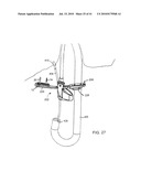 Methods for the Surgical Application of a Fastener and the Endoluminal Treatment of Gastroesophageal Reflux Disease (GERD) diagram and image