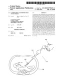 Laparoscopic Anastomosis Tools And Technique diagram and image