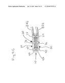 APPARATUS AND METHODS FOR DEPLOYING A CLIP TO OCCLUDE AN ANATOMICAL STRUCTURE diagram and image